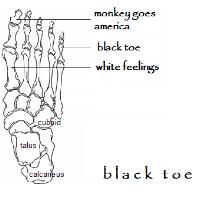 Black Toe